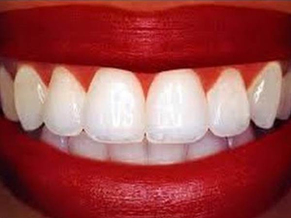 10 trucos para conseguir los dientes más blancos